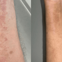 Before and after comparison of a man's arm using Blakely Bath & Co products, showing dry, rough skin transformed into smooth, hydrated, and healthy-looking skin